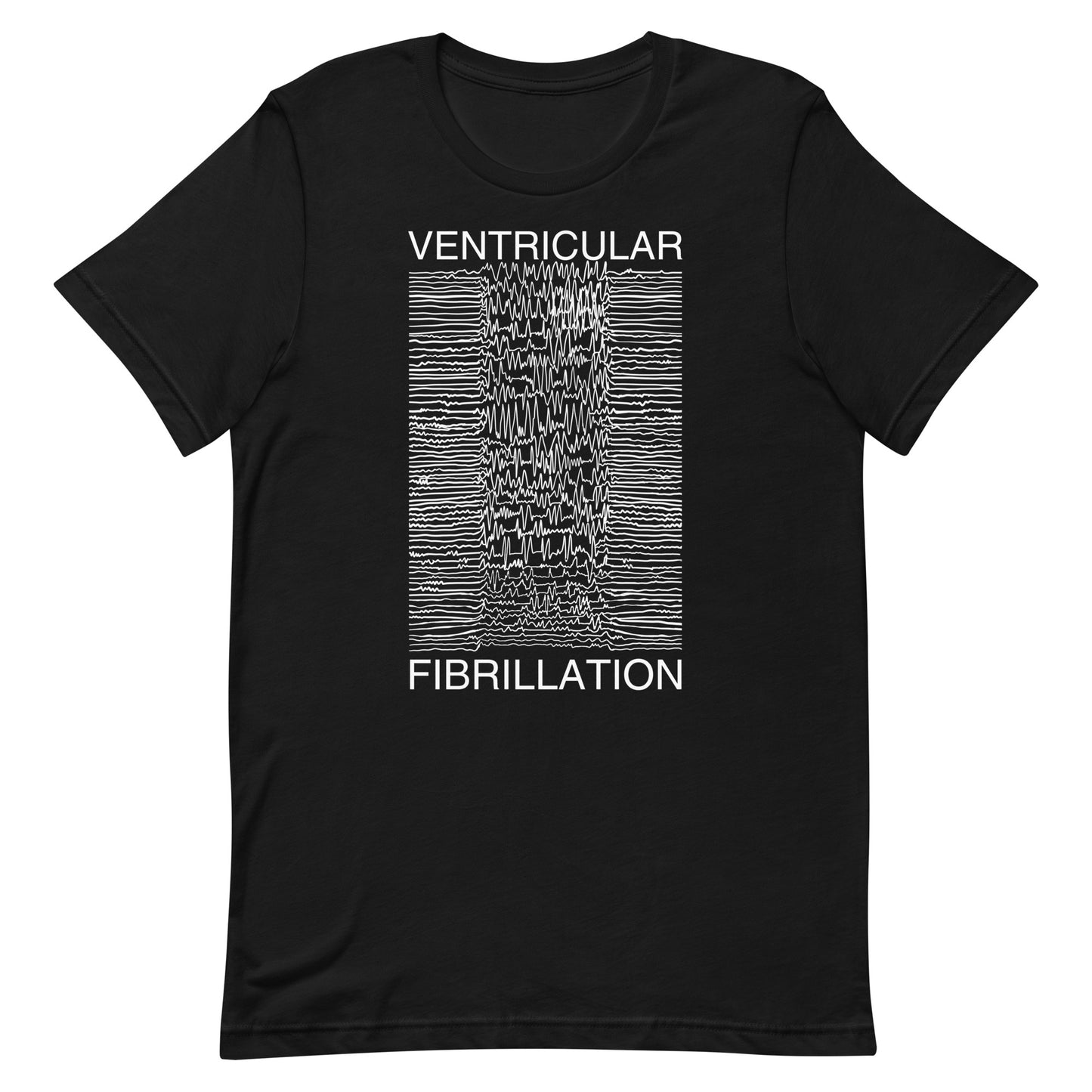 Ventricular Fibrillation Tee